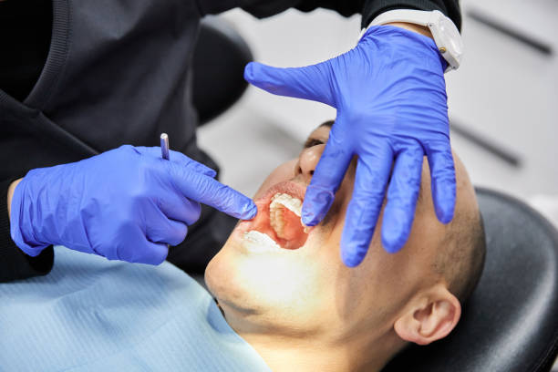 Best Emergency Root Canal Treatment in Jacksonville, TX