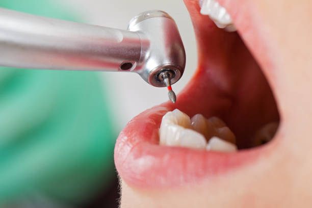 Best After-Hours Emergency Dentist in Jacksonville, TX
